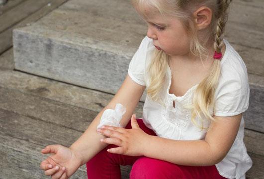How to Avoid Eczema Flare Ups This Summer